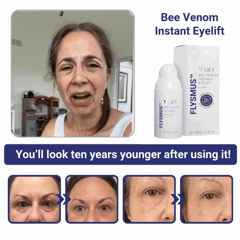 [🍎Official Brand Store]Flysmus™ V-Lift Instant Eye Lift and Eye Tuck Bee Venom Serum for Puffy Eyes- LAST DAY 70% OFF