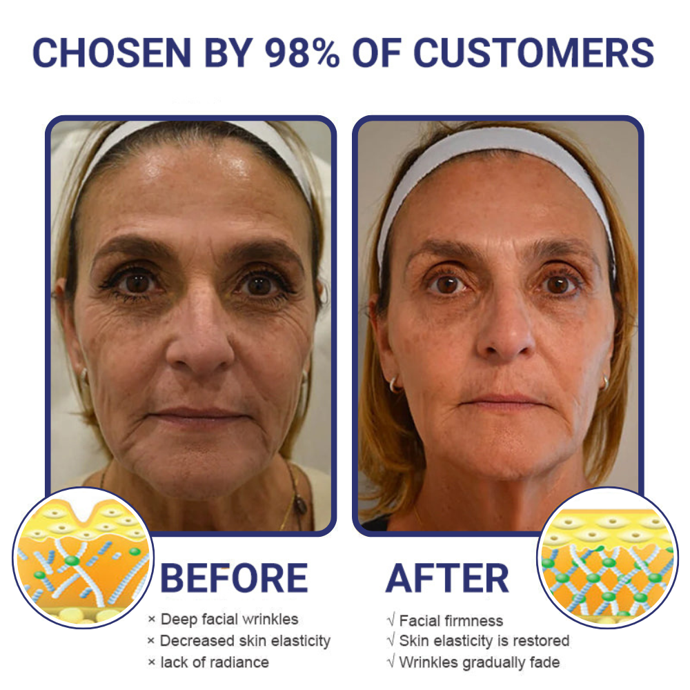 [🍎Official Brand Store]Flysmus™ V-Lift Instant Eye Lift and Eye Tuck Bee Venom Serum for Puffy Eyes- LAST DAY 70% OFF
