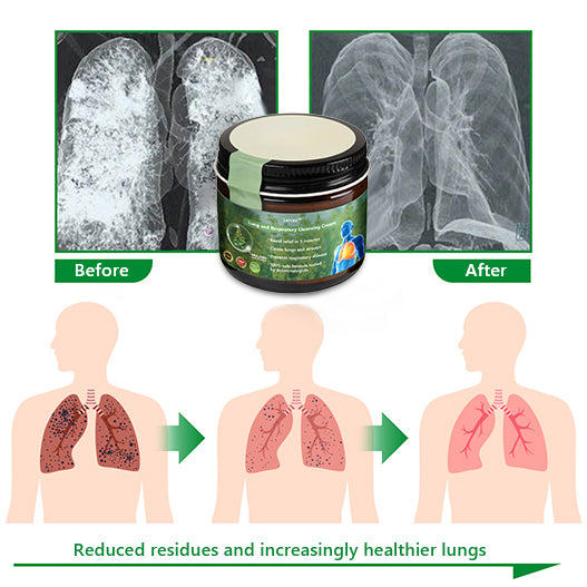 ✨Official Store:Lercea™ 👑Mullein Clear Lung Repair Cre am - endorsed by the British Thoracic Society to support lung health🎉🎉